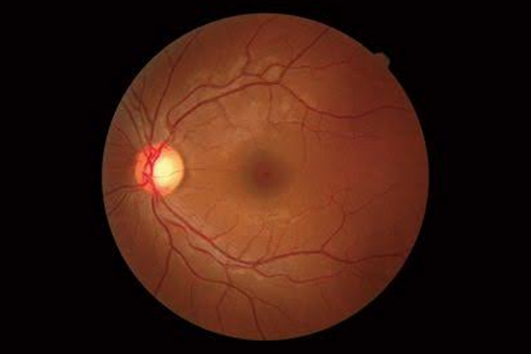 Best-Eye-Surgeon-in-Thane